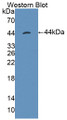 Defensin Alpha 11 (DEFa11) Polyclonal Antibody, CAU31354