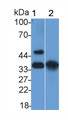 Epithelial Cell Adhesion Molecule (EPCAM) Polyclonal Antibody, CAU31376