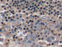 DAB staining on IHC-P; Samples: Human Tonsil Tissue; Primary Ab: 10µg/ml Rabbit Anti-Human ACTb Antibody Second Ab: 2µg/mL HRP-Linked Caprine Anti-Rabbit IgG Polyclonal Antibody