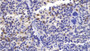DAB staining on IHC-P; Samples: Mouse Spleen Tissue;  Primary Ab: 20µg/ml Rabbit Anti-Mouse FceRI Antibody Second Ab: 2µg/mL HRP-Linked Caprine Anti-Rabbit IgG Polyclonal Antibody 