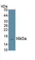 Chemokine C-C-Motif Receptor 7 (CCR7) Polyclonal Antibody, CAU31430