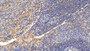 DAB staining on IHC-P; Samples: Human Spleen Tissue; Primary Ab: 10µg/ml Rabbit Anti-Human GITR Antibody Second Ab: 2µg/mL HRP-Linked Caprine Anti-Rabbit IgG Polyclonal Antibody