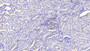 DAB staining on IHC-P; Samples: Human Kidney Tissue;  Primary Ab: 20μg/ml Rabbit Anti-Human Pgp Antibody Second Ab: 2µg/mL HRP-Linked Caprine Anti-Rabbit IgG Polyclonal Antibody 