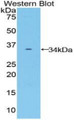 Frizzled Homolog 10 (FZD10) Polyclonal Antibody, CAU31475