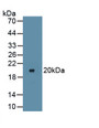 Inhibitory Subunit Of NF Kappa B Alpha (IkBa) Polyclonal Antibody, CAU31477