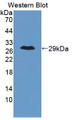 Lectin Like Oxidized Low Density Lipoprotein Receptor 1 (LOX1) Polyclonal Antibody, CAU31481