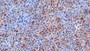 DAB staining on IHC-P; Samples: Mouse Liver Tissue;  Primary Ab: 10µg/ml Rabbit Anti-Mouse APOB Antibody Second Ab: 2µg/mL HRP-Linked Caprine Anti-Rabbit IgG Polyclonal Antibody 