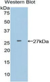 Adenomatosis Polyposis Coli Protein (APC) Polyclonal Antibody, CAU31551