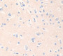 Adenomatosis Polyposis Coli Protein (Apc) Polyclonal Antibody, Cat#CAU31551