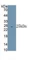 Heat Shock 70kDa Protein 5 (HSPA5) Polyclonal Antibody, CAU31553