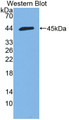 Hemicentin 1 (HMCN1) Polyclonal Antibody, CAU31574