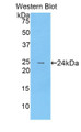 Osteoclast Associated Receptor (OSCAR) Polyclonal Antibody, CAU31580