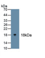 Tumor Protein P63 (TP63) Polyclonal Antibody, CAU31587