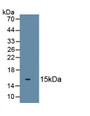 Twist Transcription Factor (TWIST) Polyclonal Antibody, CAU31589