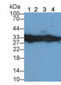 Platelet Derived Growth Factor Subunit B (PDGFB) Polyclonal Antibody, CAU31606