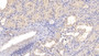 DAB staining on IHC-P; Samples: Porcine Kidney Tissue; Primary Ab: 20µg/ml Rabbit Anti-Porcine PDGFB Antibody Second Ab: 2µg/mL HRP-Linked Caprine Anti-Rabbit IgG Polyclonal Antibody