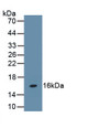 Follicle Stimulating Hormone Beta (FSHb) Polyclonal Antibody, CAU31616