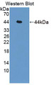 Sjogren Syndrome Antigen A2 (SSA2) Polyclonal Antibody, CAU31642