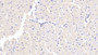 DAB staining on IHC-P; Samples: Mouse Cardiac Muscle Tissue;  Primary Ab: 20µg/ml Rabbit Anti-Mouse SSA1 Antibody Second Ab: 2µg/mL HRP-Linked Caprine Anti-Rabbit IgG Polyclonal Antibody 