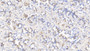 DAB staining on IHC-P; Samples: Human Stomach Tissue; Primary Ab: 10µg/ml Rabbit Anti-Human MYH9 Antibody Second Ab: 2µg/mL HRP-Linked Caprine Anti-Rabbit IgG Polyclonal Antibody