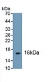 Glucagon Like Peptide 1 Receptor (GLP1R) Polyclonal Antibody, CAU31660