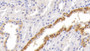 DAB staining on IHC-P; Samples: Human Kidney Tissue;  Primary Ab: 30µg/ml  Rabbit Anti-Human MAPKAP1 Antibody Second Ab: 2µg/mL HRP-Linked Caprine Anti-Rabbit IgG Polyclonal Antibody 