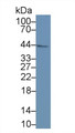 Runt Related Transcription Factor 1 (RUNX1) Polyclonal Antibody, CAU31681