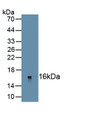 Nerve Growth Factor IB (NGFIB) Polyclonal Antibody, CAU31709