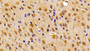 DAB staining on IHC-P; Samples: Mouse Cerebrum Tissue;  Primary Ab: 10μg/ml Rabbit Anti-Mouse CALY Antibody Second Ab: 2µg/mL HRP-Linked Caprine Anti-Rabbit IgG Polyclonal Antibody 
