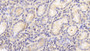 DAB staining on IHC-P; Samples: Human Stomach Tissue;  Primary Ab: 20μg/ml Rabbit Anti-Human CTSO Antibody Second Ab: 2µg/mL HRP-Linked Caprine Anti-Rabbit IgG Polyclonal Antibody 