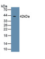 B-Cell CLL/Lymphoma 7A (Bcl7A) Polyclonal Antibody, CAU31746