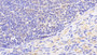 DAB staining on IHC-P; Samples: Human Lymph node Tissue; Primary Ab: 20μg/ml Rabbit Anti-Human GBP5 Antibody Second Ab: 2µg/mL HRP-Linked Caprine Anti-Rabbit IgG Polyclonal Antibody