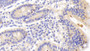 DAB staining on IHC-P; Samples: Human Small intestine Tissue;  Primary Ab: 20μg/ml Rabbit Anti-Human GBP5 Antibody Second Ab: 2µg/mL HRP-Linked Caprine Anti-Rabbit IgG Polyclonal Antibody 
