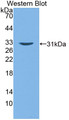 Guanylate Binding Protein 2, Interferon Inducible (GBP2) Polyclonal Antibody, CAU31753