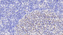 DAB staining on IHC-P; Samples: Human Lymph node Tissue;  Primary Ab: 20μg/ml Rabbit Anti-Human MCM3 Antibody Second Ab: 2µg/mL HRP-Linked Caprine Anti-Rabbit IgG Polyclonal Antibody 