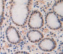 Used in DAB staining on fromalin fixed paraffin- embedded stomach tissue