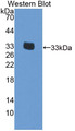 Eukaryotic Translation Initiation Factor 2 Subunit 1 (EIF2S1) Polyclonal Antibody, CAU31778