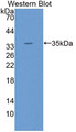 Eukaryotic Translation Initiation Factor 4A1 (EIF4A1) Polyclonal Antibody, CAU31779