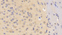 DAB staining on IHC-P; Samples: Mouse Cerebrum Tissue;  Primary Ab: 20µg/ml Rabbit Anti-Mouse DLG4 Antibody Second Ab: 2µg/mL HRP-Linked Caprine Anti-Rabbit IgG Polyclonal Antibody 