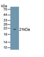Translocation Associated Notch Homolog 1 (TAN1) Polyclonal Antibody, CAU31853