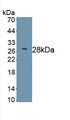 Suppressors Of Cytokine Signaling 1 (SOCS1) Polyclonal Antibody, CAU31862