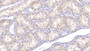 DAB staining on IHC-P; Samples: Human Kidney Tissue;  Primary Ab: 10µg/ml Rabbit Anti-Human DAO Antibody Second Ab: 2µg/mL HRP-Linked Caprine Anti-Rabbit IgG Polyclonal Antibody 
