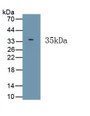 Hermansky Pudlak Syndrome Protein 6 (HPS6) Polyclonal Antibody, CAU31901