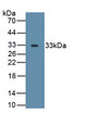 Osterix (OSX) Polyclonal Antibody, CAU31902