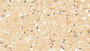 DAB staining on IHC-P; Samples: Human Cerebrum Tissue; Primary Ab: 20μg/ml Rabbit Anti-Human WNT7B Antibody Second Ab: 2µg/mL HRP-Linked Caprine Anti-Rabbit IgG Polyclonal Antibody