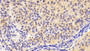 DAB staining on IHC-P; Samples: Human Ovary Tissue; Primary Ab: 20μg/ml Mouse Anti-Human INHA Antibody Second Ab: 2µg/mL HRP-Linked Caprine Anti-Mouse IgG Polyclonal Antibody