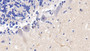 DAB staining on IHC-P; Samples: Human Small intestine Tissue; Primary Ab: 30µg/ml Rabbit Anti-Human APOB48 Antibody Second Ab: 2µg/mL HRP-Linked Caprine Anti-Rabbit IgG Polyclonal Antibody