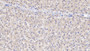 DAB staining on IHC-P; Samples: Human Liver Tissue;  Primary Ab: 30µg/ml Rabbit Anti-Human APOB48 Antibody Second Ab: 2µg/mL HRP-Linked Caprine Anti-Rabbit IgG Polyclonal Antibody 