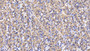 DAB staining on IHC-P; Sample: Human Stomach Tissue; Primary Ab: 20μg/ml Mouse Anti-Human SQSTM1 Antibody Second Ab: 2µg/mL HRP-Linked Caprine Anti-Mouse IgG Polyclonal Antibody