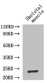 Western Blot; ,Positive WB detected in: Mouse skeletal muscle tissue; ,All lanes: IL6 antibody at 2µg/ml; ,Secondary; ,Goat polyclonal to rabbit IgG at 1/50000 dilution; ,Predicted band size: 24 kDa; ,Observed band size: 24 kDa